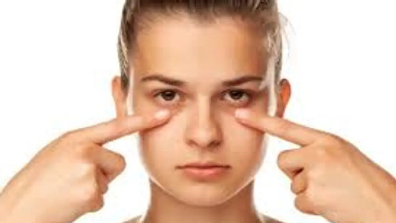 കണ്ണിന് ചുറ്റുമുള്ള 'ഡാർക്ക് സർക്കിൾസ്' മാറ്റാൻ ഈ ചേരുവകള്‍ ഉപയോ​ഗിക്കൂ...