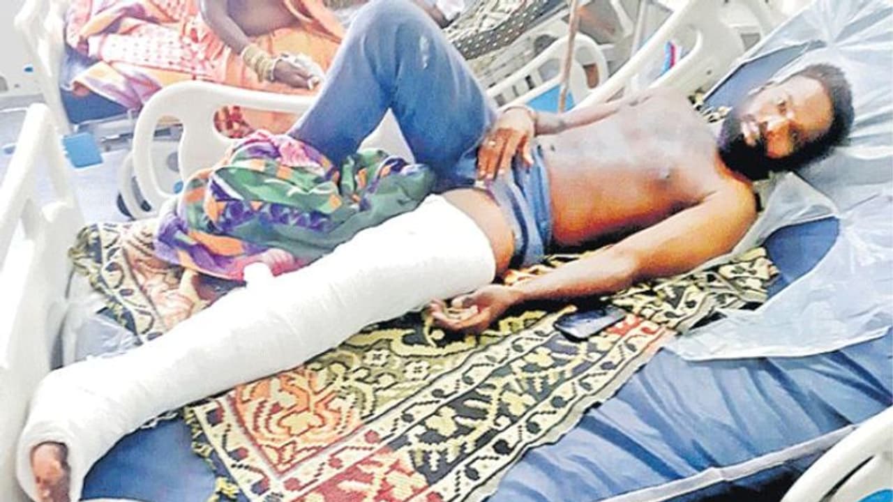 Hyderabad: జిమ్ ట్రైనర్పై పోలీసుల దాష్టీకం.. విచక్షణరహితంగా కర్రలతో కొట్టి.. కాళ్లతో తన్ని.. Hyderabad: జిమ్ ట్రైనర్పై పోలీసుల దాష్టీకం.. విచక్షణరహితంగా కర్రలతో కొట్టి.. కాళ్లతో తన్ని..