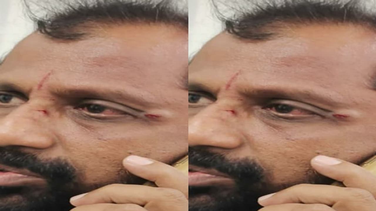 తిరుమల వెంకన్న సన్నిధిలో ఎమ్మెల్యే అనుచరుడి వీరంగం... టిటిడి ఉద్యోగిపై దాడి