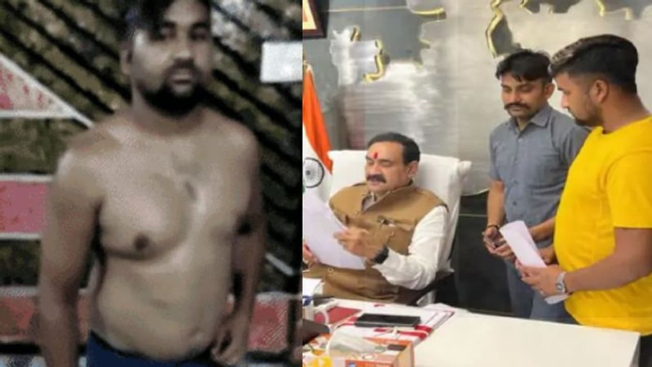 MP में पुलिसवालों की थर्ड डिग्री: युवक को इतना पीटा की गर्दन की हड्डी टूट गई, कान का पर्दा फटा उधड़ गई चमड़ी MP में पुलिसवालों की थर्ड डिग्री: युवक को इतना पीटा की गर्दन की हड्डी टूट गई, कान का पर्दा फटा उधड़ गई चमड़ी