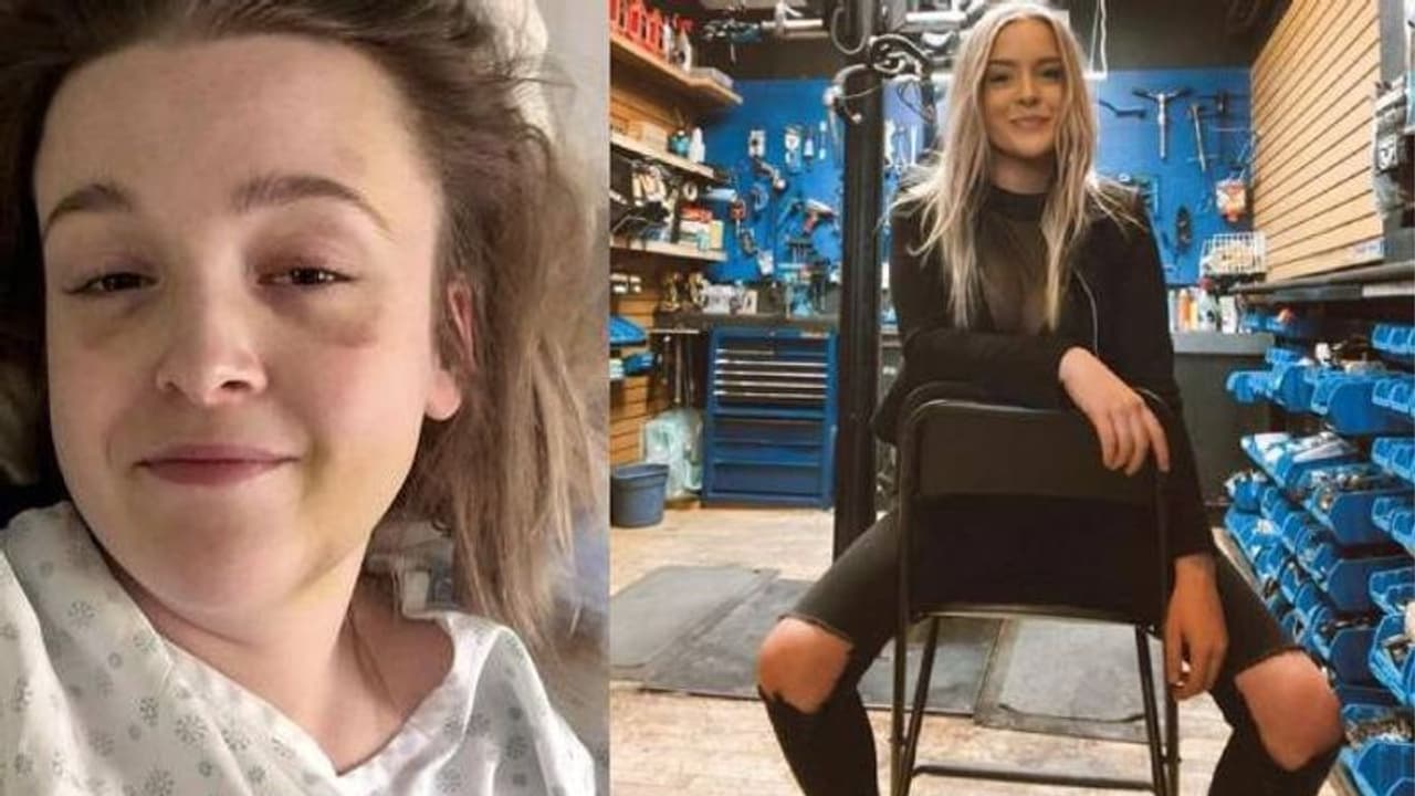 നാലാഴ്ചത്തെ കോമ, എഴുന്നേറ്റപ്പോൾ കാമുകൻ പുതിയ പങ്കാളിക്കൊപ്പം, തകർന്നുപോയെന്ന് യുവതി നാലാഴ്ചത്തെ കോമ, എഴുന്നേറ്റപ്പോൾ കാമുകൻ പുതിയ പങ്കാളിക്കൊപ്പം, തകർന്നുപോയെന്ന് യുവതി