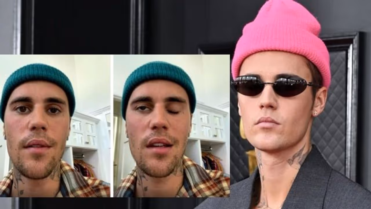 'തനിക്ക് റാംസെ ഹണ്ട് സിൻഡ്രോം': മുഖത്ത് പക്ഷാഘാതം വന്നു വെളിപ്പെടുത്തി ജസ്റ്റിൻ ബീബർ