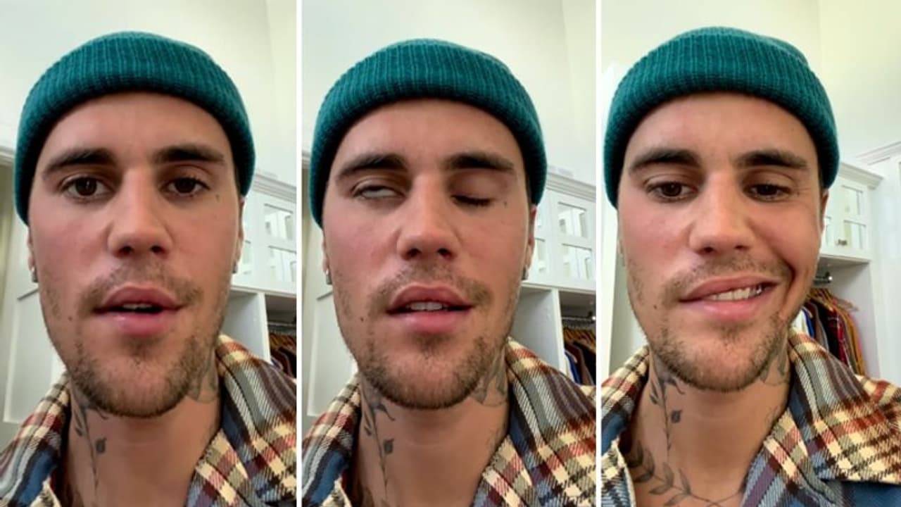 एक वायरस ने बिगाड़ दिया 28 साल के जस्टिन बीबर का चेहरा, बोले न मैं आंख झपका सकता हूं और न ही मुस्करा सकता हूं एक वायरस ने बिगाड़ दिया 28 साल के जस्टिन बीबर का चेहरा, बोले न मैं आंख झपका सकता हूं और न ही मुस्करा सकता हूं