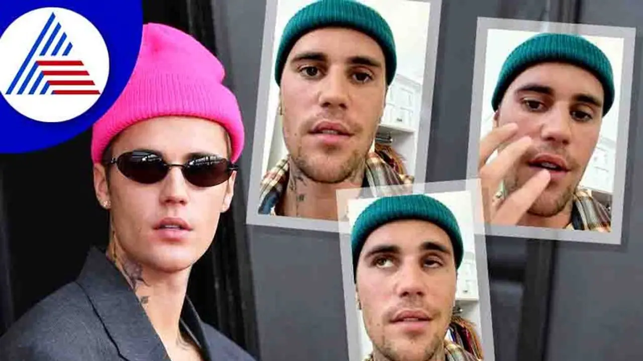 ಗಾಯಕ ಜಸ್ಟಿನ್ ಬೀಬರ್ ಮುಖಕ್ಕೆ ಪಾರ್ಶ್ವವಾಯು; ನಗಲೂ ಆಗದ ವಿಚಿತ್ರ ಕಾಯಿಲೆಗೆ ಕಾರಣವಾಗೋದೇನು ? ಗಾಯಕ ಜಸ್ಟಿನ್ ಬೀಬರ್ ಮುಖಕ್ಕೆ ಪಾರ್ಶ್ವವಾಯು; ನಗಲೂ ಆಗದ ವಿಚಿತ್ರ ಕಾಯಿಲೆಗೆ ಕಾರಣವಾಗೋದೇನು ?