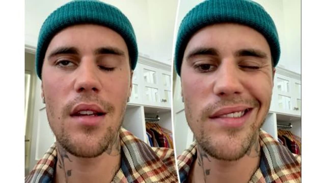 ராம்சே ஹன்ட் சிண்ட்ரோம் என்றால் என்ன? கண்டறிவது எப்படி?