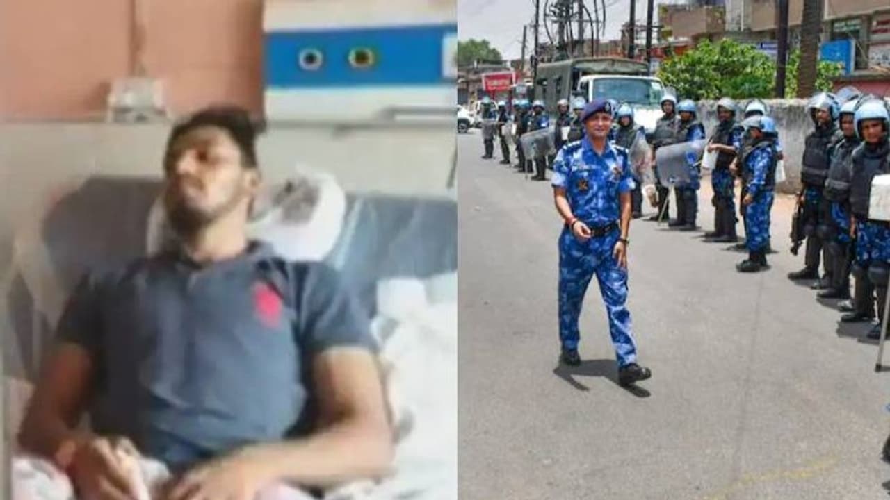 നുപുര് ശര്മ്മയ്ക്കെതിരായ പ്രതിഷേധം; 6 തവണ വെടിയേറ്റ് യുവാവ്, 2 വെടിയുണ്ടകൾ ഇനിയും പുറത്തെടുക്കാനായില്ല നുപുര് ശര്മ്മയ്ക്കെതിരായ പ്രതിഷേധം; 6 തവണ വെടിയേറ്റ് യുവാവ്, 2 വെടിയുണ്ടകൾ ഇനിയും പുറത്തെടുക്കാനായില്ല