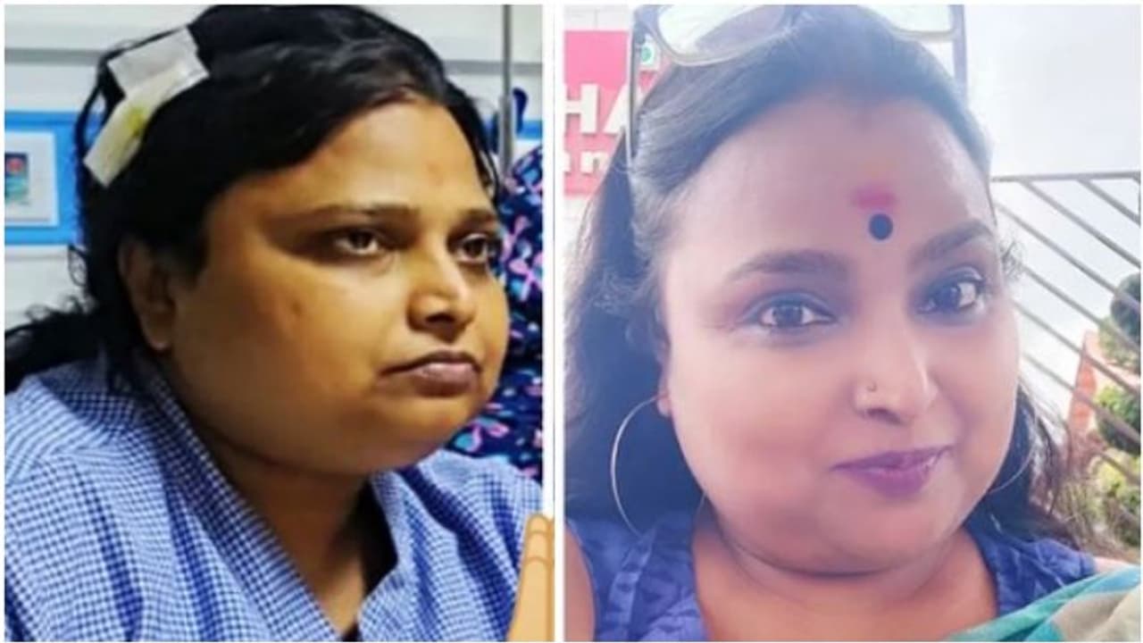 ಅಪಘಾತದ ಬಳಿಕ ಹೇಗಿದ್ದಾರೆ ಸುನೇತ್ರಾ ಪಂಡಿತ್; ಫೋಟೋ ಶೇರ್ ಮಾಡಿದ ನಟಿ ಅಪಘಾತದ ಬಳಿಕ ಹೇಗಿದ್ದಾರೆ ಸುನೇತ್ರಾ ಪಂಡಿತ್; ಫೋಟೋ ಶೇರ್ ಮಾಡಿದ ನಟಿ