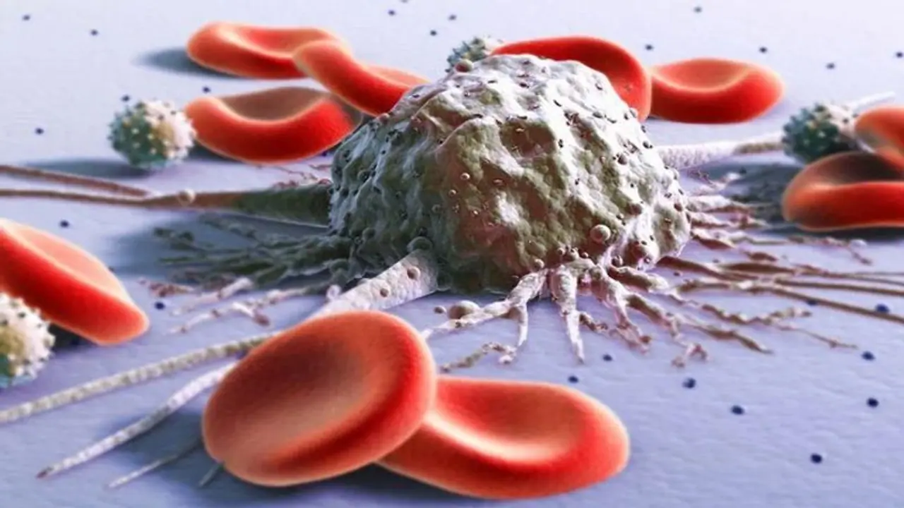 World Blood Donor Day 2022: ब्लड से जुड़ी ये 6 बीमारियां हो सकती हैं जानलेवा, जानें लक्षण और बचाव World Blood Donor Day 2022: ब्लड से जुड़ी ये 6 बीमारियां हो सकती हैं जानलेवा, जानें लक्षण और बचाव