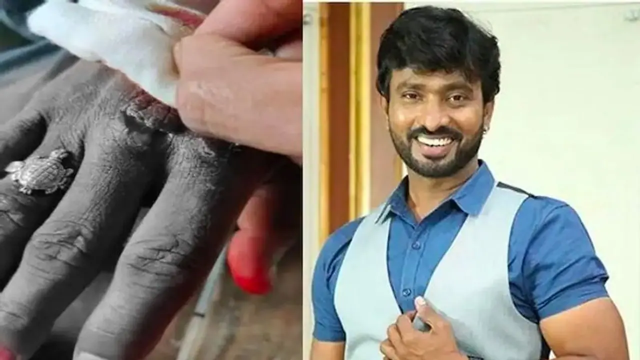 జబర్దస్త్ అదిరే అభికి తీవ్ర గాయాలు.. చేతికి 15 కుట్లు.. షూటింగ్ సమయంలో ప్రమాదం.. జబర్దస్త్ అదిరే అభికి తీవ్ర గాయాలు.. చేతికి 15 కుట్లు.. షూటింగ్ సమయంలో ప్రమాదం..