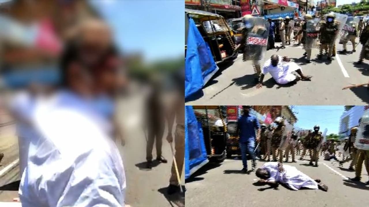 തൊടുപുഴ യൂത്ത് കോൺഗ്രസ് മാർച്ച്: പരിക്കേറ്റ ബിലാൽ സമദിന്റെ നില ഗുരുതരം, സ്വകാര്യ ആശുപത്രിയിലേക്ക് മാറ്റി തൊടുപുഴ യൂത്ത് കോൺഗ്രസ് മാർച്ച്: പരിക്കേറ്റ ബിലാൽ സമദിന്റെ നില ഗുരുതരം, സ്വകാര്യ ആശുപത്രിയിലേക്ക് മാറ്റി