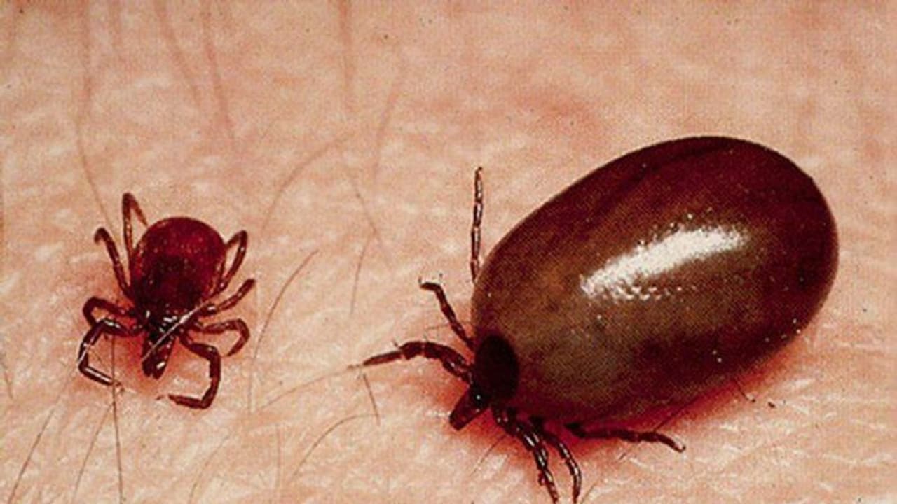 ಉತ್ತರ ಭಾರತದಲ್ಲಿ ಭೀಕರ ಉಣುಗು ಕಾಟ, ಒಟ್ಟು 14 ಮಂದಿ ಸಾವು, 700 ಕ್ಕೂ ಹೆಚ್ಚು ಪ್ರಕರಣ ಬೆಳಕಿಗೆ! ಉತ್ತರ ಭಾರತದಲ್ಲಿ ಭೀಕರ ಉಣುಗು ಕಾಟ, ಒಟ್ಟು 14 ಮಂದಿ ಸಾವು, 700 ಕ್ಕೂ ಹೆಚ್ಚು ಪ್ರಕರಣ ಬೆಳಕಿಗೆ!