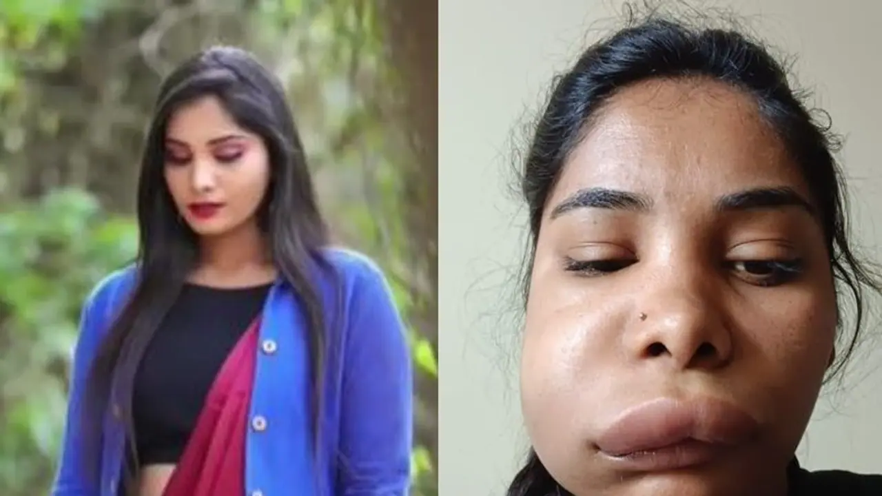 பல் வலிக்காக சிகிச்சைக்கு போன நடிகை.. பலூன் போல் வீங்கிய முகத்துடன் திரும்பி வந்த சோகம் என்ன நடந்தது? பல் வலிக்காக சிகிச்சைக்கு போன நடிகை.. பலூன் போல் வீங்கிய முகத்துடன் திரும்பி வந்த சோகம் என்ன நடந்தது?