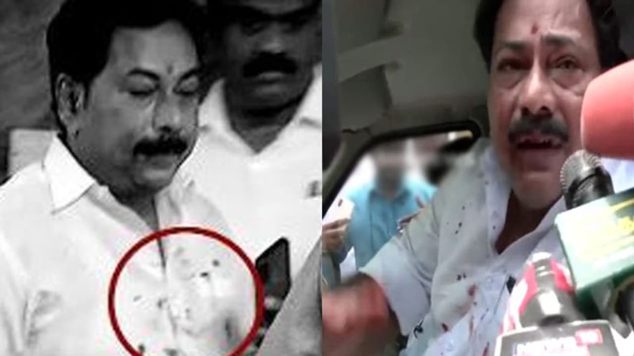 EPS ஆதரவாளர் மீது தாக்குதல்.. ரத்தம் சொட்ட சொட்ட ஹாஸ்பிட்டலுக்கு போகாமல் என்ன செய்தார் தெரியுமா?