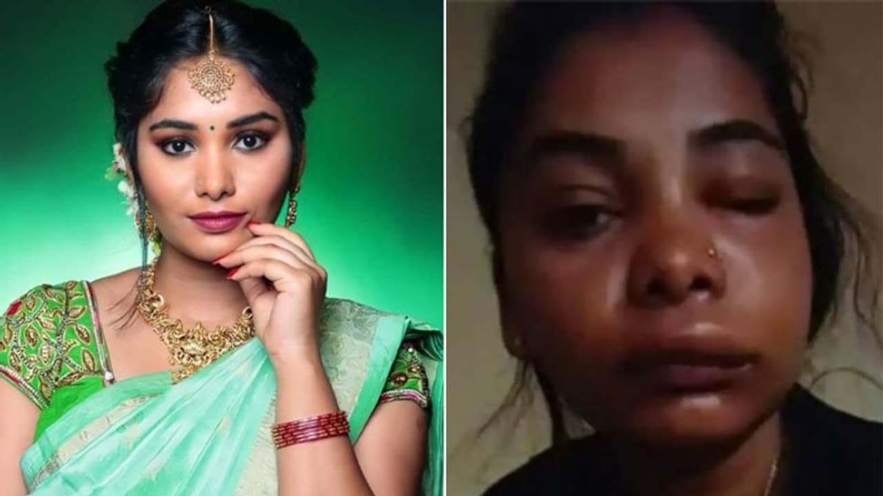 सर्जरी से चेहरा बिगड़ा तो फ़िल्में TV शो छूटे और नौकरी भी हाथ से गई, एक्ट्रेस ने सुनाई आपबीती