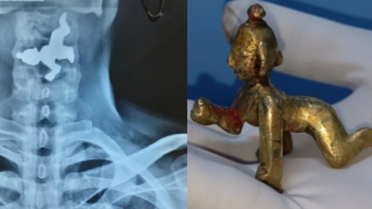 Belagavi News: ಗಂಟಲಲ್ಲಿ ಸಿಕ್ಕ ಕೃಷ್ಣನ ಮೂರ್ತಿ, ಕಾಪಾಡಿದನಾ ಆ ದೇವರು? Belagavi News: ಗಂಟಲಲ್ಲಿ ಸಿಕ್ಕ ಕೃಷ್ಣನ ಮೂರ್ತಿ, ಕಾಪಾಡಿದನಾ ಆ ದೇವರು?