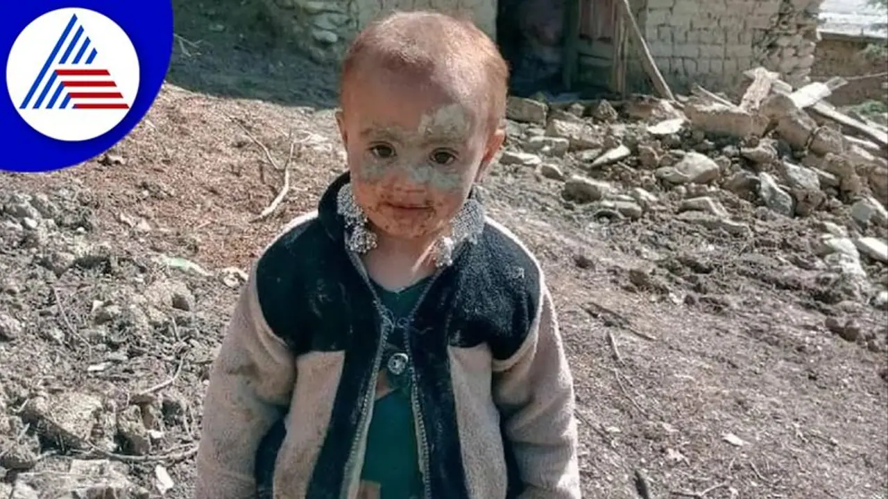 ಅಫ್ಘನ್ ಭೂಕಂಪದಲ್ಲಿ ತನ್ನವರನ್ನೆಲ್ಲಾ ಕಳೆದುಕೊಂಡ 3 ವರ್ಷದ ಮಗುವಿಗೆ ಮರುಗಿದ ಜನ! ಅಫ್ಘನ್ ಭೂಕಂಪದಲ್ಲಿ ತನ್ನವರನ್ನೆಲ್ಲಾ ಕಳೆದುಕೊಂಡ 3 ವರ್ಷದ ಮಗುವಿಗೆ ಮರುಗಿದ ಜನ!