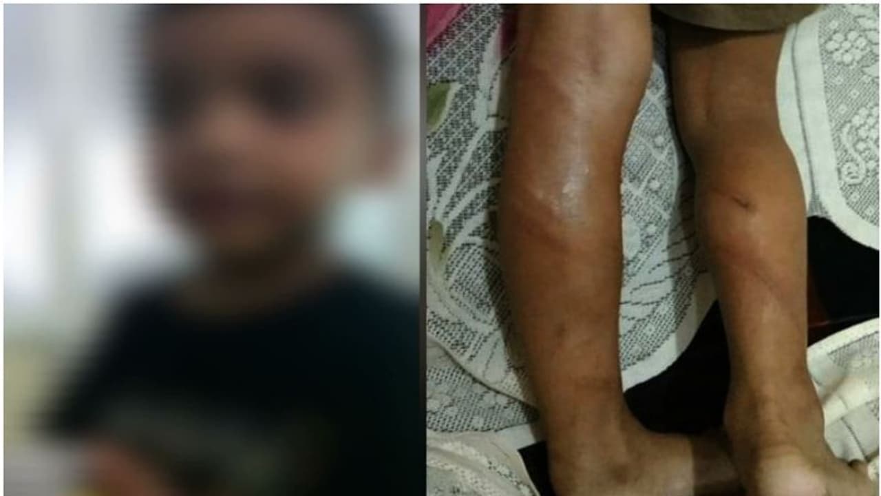 ഇംഗ്ലീഷ് അക്ഷരങ്ങൾ പറഞ്ഞില്ല; എറണാകുളത്ത് നാല് വയസുകാരനെ ക്രൂരമായി മര്ദ്ദിച്ച് ട്യൂഷൻ അധ്യാപകന് ഇംഗ്ലീഷ് അക്ഷരങ്ങൾ പറഞ്ഞില്ല; എറണാകുളത്ത് നാല് വയസുകാരനെ ക്രൂരമായി മര്ദ്ദിച്ച് ട്യൂഷൻ അധ്യാപകന്