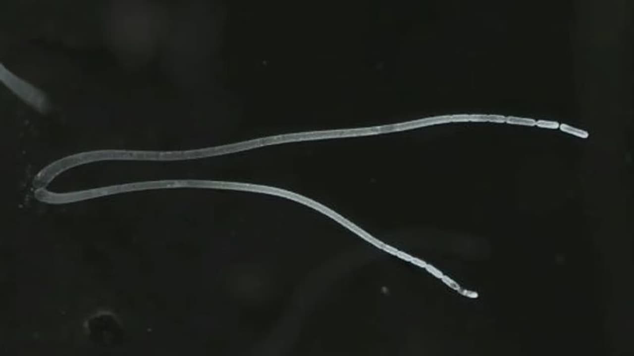 वैज्ञानिकों ने खोजा दुनिया का सबसे बड़ा बैक्टीरिया, नंगी आखों से भी आता है नजर