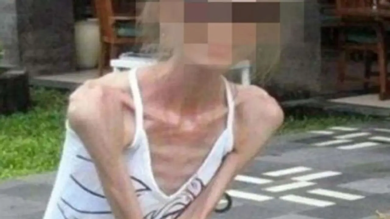 स्लिम होने को लड़की ने अपनाए अजब तरीके, सालभर में 65 से 25 किलो हुआ वजन, उसके बाद जानिए क्या हुआ उसके साथ स्लिम होने को लड़की ने अपनाए अजब तरीके, सालभर में 65 से 25 किलो हुआ वजन, उसके बाद जानिए क्या हुआ उसके साथ