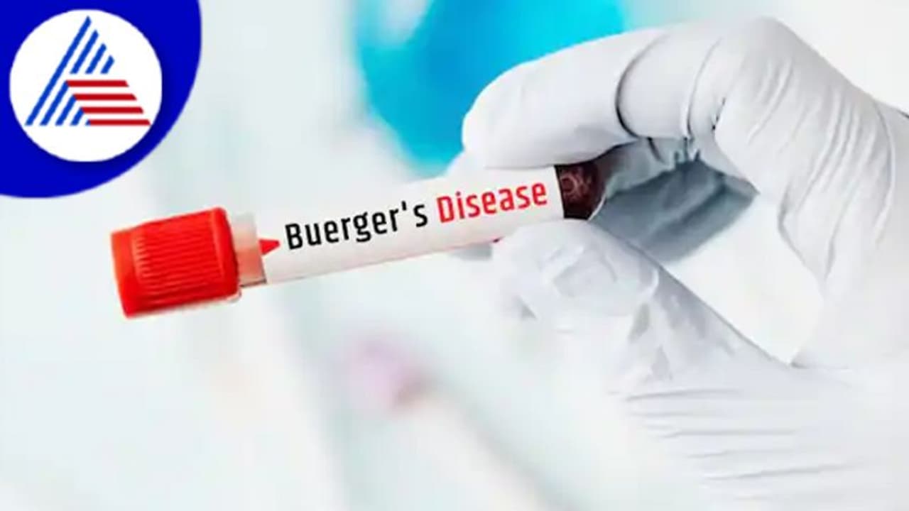 ಧೂಮಪಾನಿಗಳನ್ನು ಕಾಡ್ತಿದೆ ಡೇಂಜರಸ್ ಬುರ್ಗರ್ಸ್ ಕಾಯಿಲೆ ಧೂಮಪಾನಿಗಳನ್ನು ಕಾಡ್ತಿದೆ ಡೇಂಜರಸ್ ಬುರ್ಗರ್ಸ್ ಕಾಯಿಲೆ