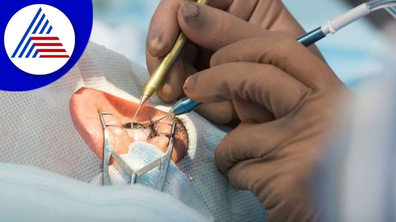 ಆಪರೇಷನ್‌ ಮಾಡಲು ಹೋಗಿ ಇದ್ದೊಂದು ಕಣ್ಣನೂ ತೆಗೆದ ವೈದ್ಯ 