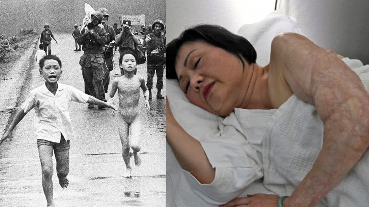 നഗ്‌നയായി പൊള്ളിയോടിയ ഈ പെണ്‍കുട്ടിയുടെ വേദന മാറി, മുറിവേല്‍പ്പിച്ച അതേ യുഎസില്‍! 