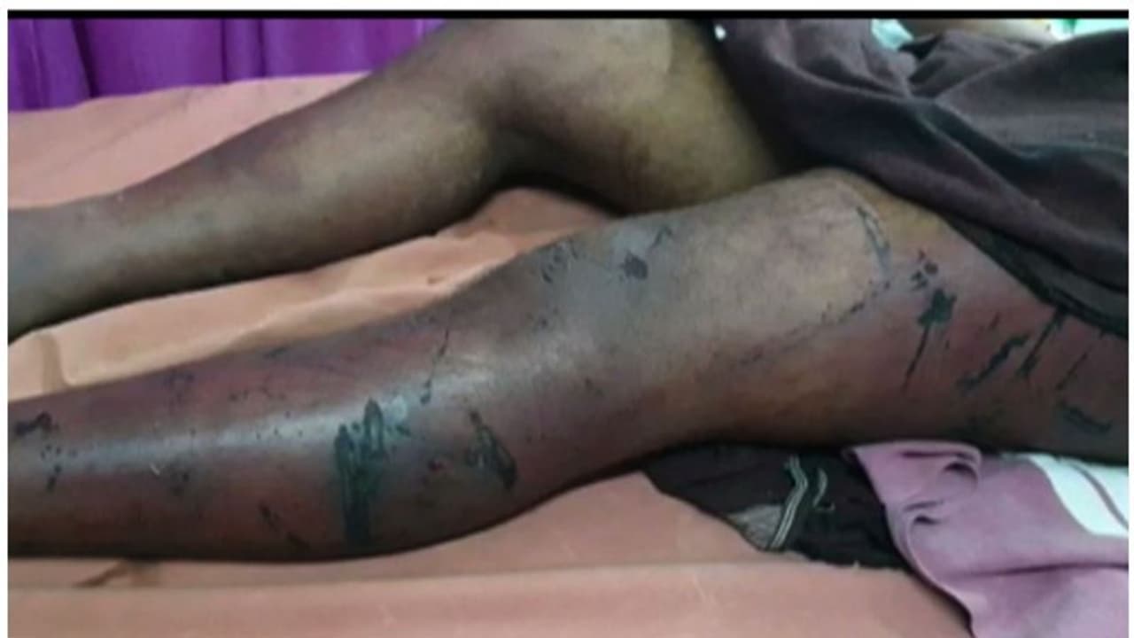 അട്ടപ്പാടിയിൽ 10 അംഗ സംഘത്തിന്‍റെ അടിയേറ്റ് ചികിത്സയിലായിരുന്ന കണ്ണൂർ സ്വദേശി വിനായകനും മരിച്ചു