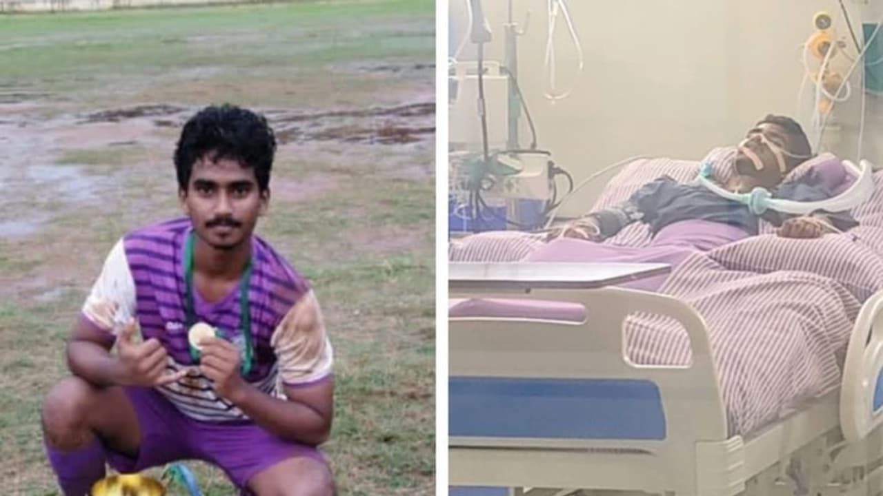 Mandya News: ವಿದ್ಯುತ್ ಶಾಕ್ ತಗುಲಿ ಫುಟ್ಬಾಲ್ ಆಟಗಾರನ ಸ್ಥಿತಿ ಗಂಭೀರ: ಆರ್ಥಿಕ ನೆರವಿನ ನಿರೀಕ್ಷೆಯಲ್ಲಿ ಪೋಷಕರು Mandya News: ವಿದ್ಯುತ್ ಶಾಕ್ ತಗುಲಿ ಫುಟ್ಬಾಲ್ ಆಟಗಾರನ ಸ್ಥಿತಿ ಗಂಭೀರ: ಆರ್ಥಿಕ ನೆರವಿನ ನಿರೀಕ್ಷೆಯಲ್ಲಿ ಪೋಷಕರು