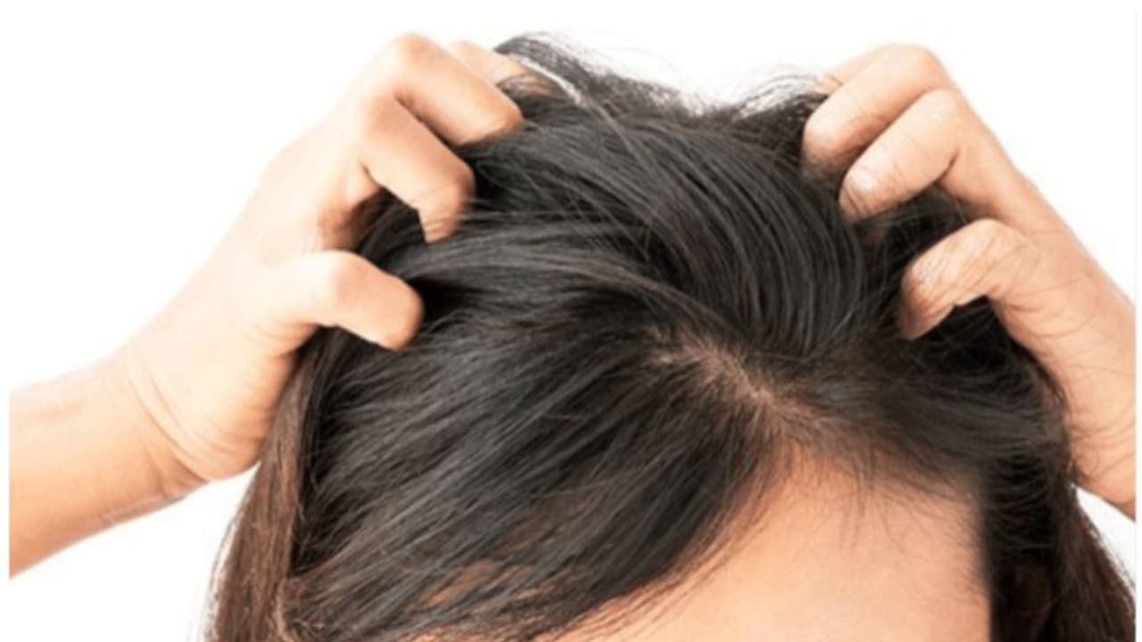 പേൻശല്യം ഫലപ്രദമായി പരിഹരിക്കാൻ ചെയ്യേണ്ട കാര്യങ്ങള്‍...