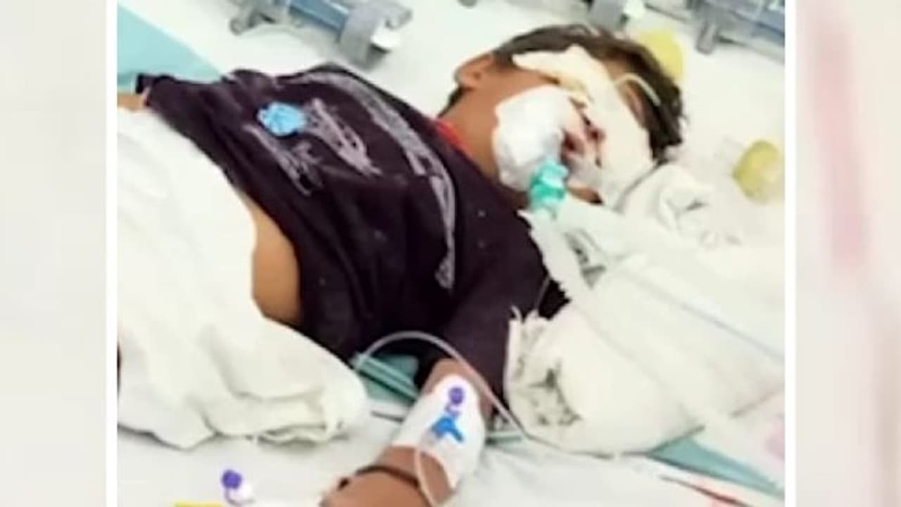 ಚಿಕಿತ್ಸೆ ಹೆಸರಲ್ಲಿ ಕುಕೃತ್ಯ: 7 ವರ್ಷದ ಮಗನಿಗೆ 40 ಕಡೆ ಬರೆ, ತಂದೆಯ ಅಟ್ಟಹಾಸಕ್ಕೆ ಮಗ ಬಲಿ! ಚಿಕಿತ್ಸೆ ಹೆಸರಲ್ಲಿ ಕುಕೃತ್ಯ: 7 ವರ್ಷದ ಮಗನಿಗೆ 40 ಕಡೆ ಬರೆ, ತಂದೆಯ ಅಟ್ಟಹಾಸಕ್ಕೆ ಮಗ ಬಲಿ!