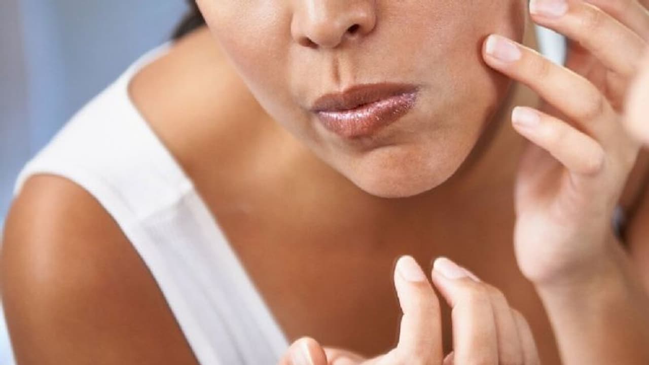 Skin Care : മുഖത്ത് വൈറ്റ്ഹെഡ്സും ബ്ലാക്ഹെഡ്സും വരുന്നത് തടയാൻ ചില മാര്‍ഗങ്ങള്‍