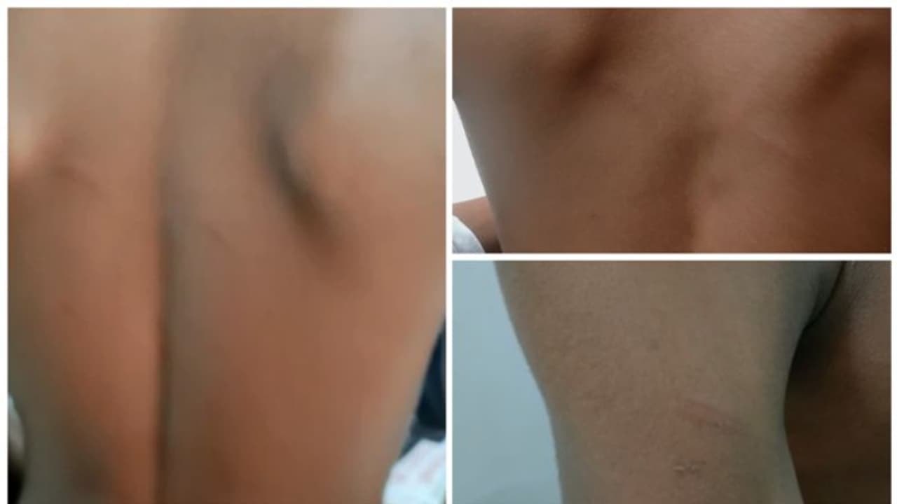 ഡെസ്കില്‍ താളമിട്ടു; തൃശ്ശൂരില്‍ സർക്കാർ പ്രീമെട്രിക് ഹോസ്റ്റലിൽ ആദിവാസി ബാലന് മർദ്ദനം