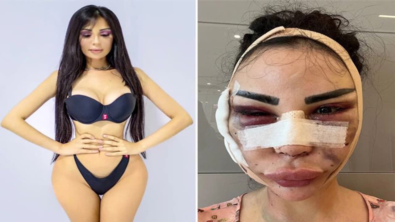 4.7cr. खर्च करके एक खूबसूरत लड़की बदसूरत बन गई, 12 साल में 40 सर्जरी करवा चली थी किम कार्दशियन बनने