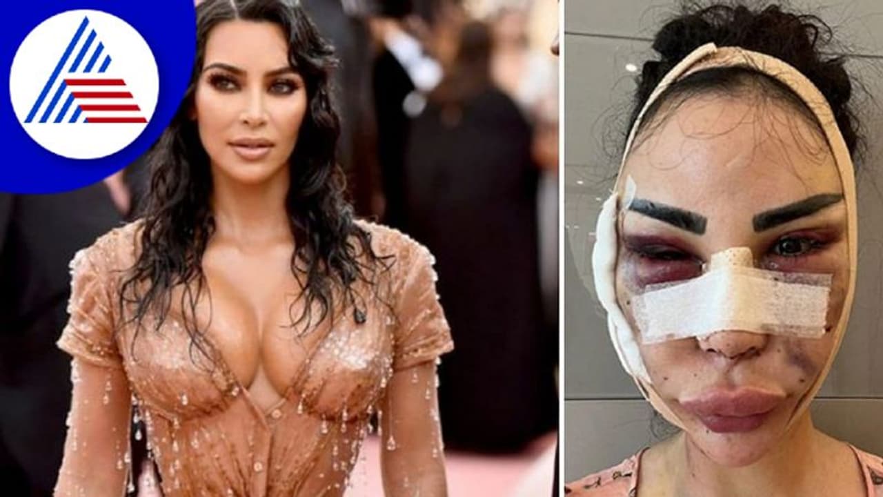 ಖ್ಯಾತ ನಟಿಯಂತೆ ಕಾಣಲು 4 ಕೋಟಿ ಖರ್ಚು, 40 ಪ್ಲಾಸ್ಟಿಕ್​ ಸರ್ಜರಿ!