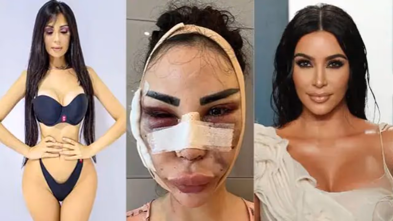 കിം കര്ദാഷിയാനെപ്പോലാവാന് 4.7 കോടി മുടക്കി 40 ശസ്ത്രക്രിയ, എന്നിട്ടും അവളിപ്പോള്... കിം കര്ദാഷിയാനെപ്പോലാവാന് 4.7 കോടി മുടക്കി 40 ശസ്ത്രക്രിയ, എന്നിട്ടും അവളിപ്പോള്...