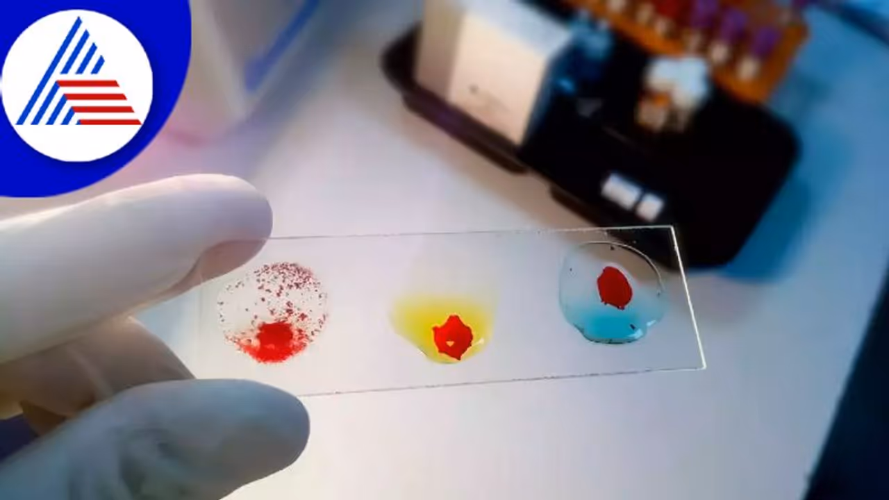 ಭಾರತದಲ್ಲಿ ಮೊದಲ ಬಾರಿ ವ್ಯಕ್ತಿಯಲ್ಲಿ ವಿಶಿಷ್ಟ ಬ್ಲಡ್ ಗ್ರೂಪ್ ಪತ್ತೆ !