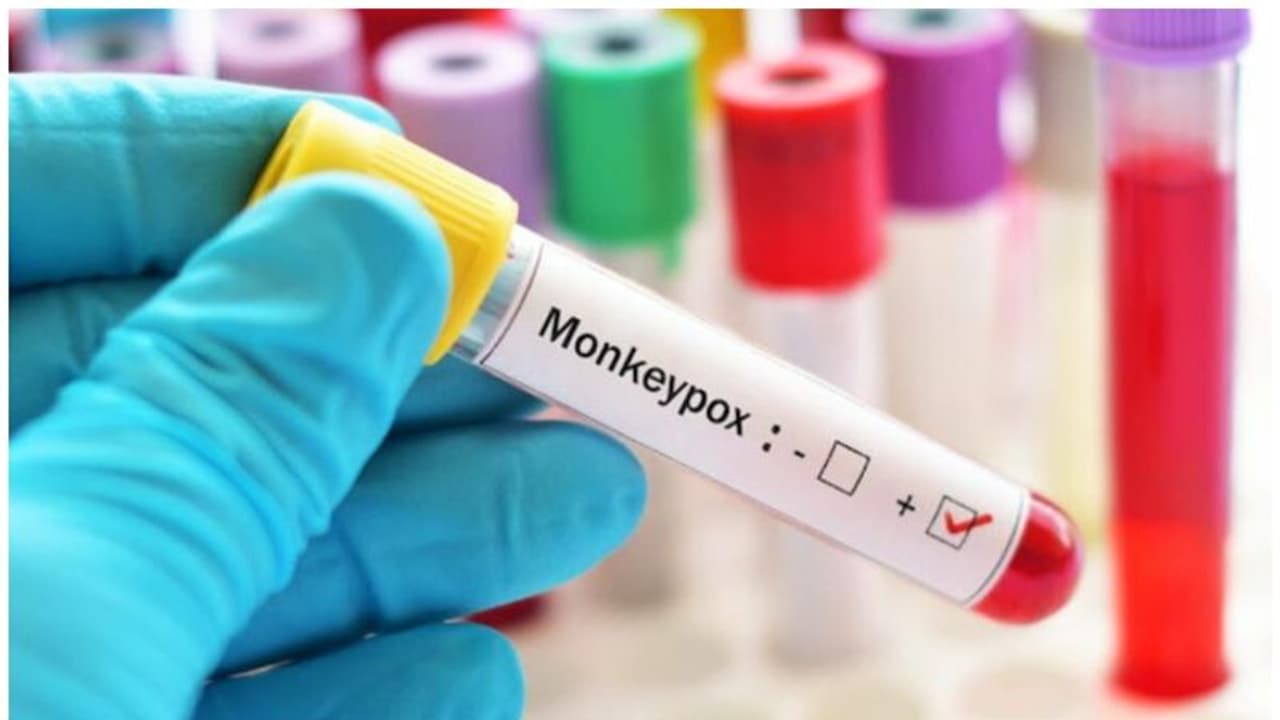 Monkeypox Symptoms : മങ്കിപോക്സ്; ശ്രദ്ധിക്കേണ്ട സാധാരണ ലക്ഷണങ്ങൾ