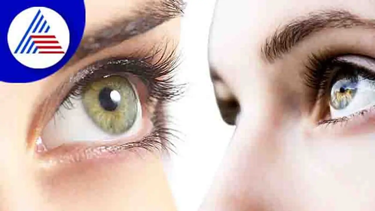 ಕಣ್ಣು ಕುಣಿಯೋದು ಶುಭ ಅಂತ ಬಿಡ್ಬೇಡಿ, ಅನಾರೋಗ್ಯವೂ ಆಗಿರಬಹುದು!