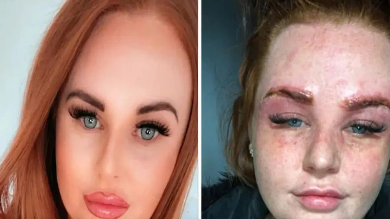 ब्यूटी पार्लर में आइब्रो बनवाने गई महिला की हुई ऐसी हालत की पहचान पाना तक हो रहा है मुश्किल