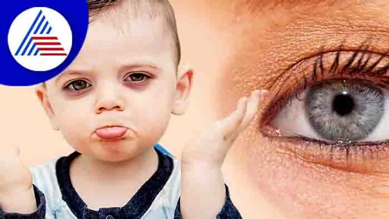 ಮಕ್ಕಳಿಗೂ ಕಾಣಿಸಿಕೊಳ್ಳುತ್ತೆ ಡಾರ್ಕ್ ಸರ್ಕಲ್…ಕಾರಣ ತಿಳ್ಕೊಂಡು ಬಿಡಿ!