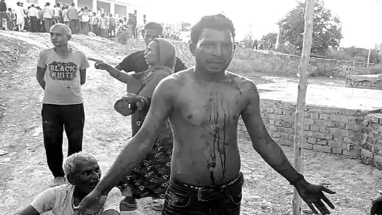 ससुराल वापस आते ही महिला पर जमकर चले लाठी डंडे, एक फोन के बाद पहुंचे मायके वालों ने जमकर मचाया तांडव ससुराल वापस आते ही महिला पर जमकर चले लाठी डंडे, एक फोन के बाद पहुंचे मायके वालों ने जमकर मचाया तांडव