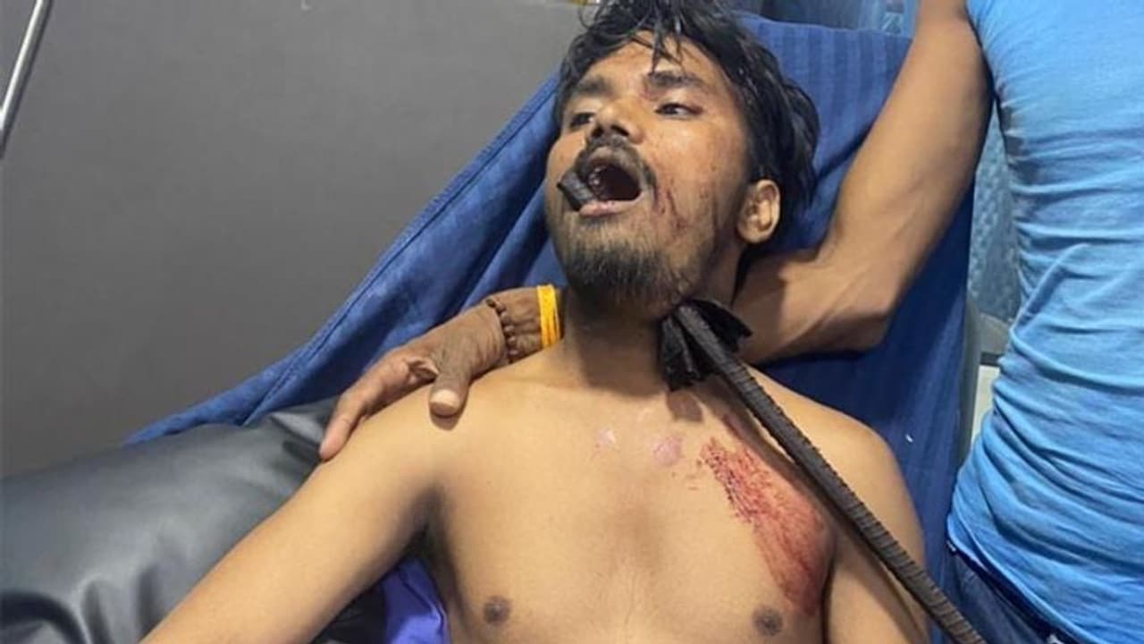 छत से गिरने पर गर्दन में छेद करते हुए मुंह से बाहर निकला 4 फीट का सरिया, फिर 2 घंटे में हो गया चमत्कार छत से गिरने पर गर्दन में छेद करते हुए मुंह से बाहर निकला 4 फीट का सरिया, फिर 2 घंटे में हो गया चमत्कार