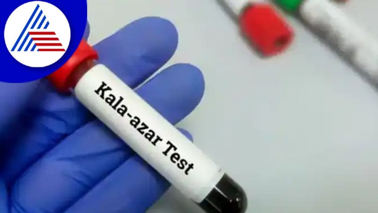 Black Fever: ಎಚ್ಚರ..! ಹರಡುತ್ತಿದೆ ಮಾರಣಾಂತಿಕ ಕಪ್ಪು ಜ್ವರ Black Fever: ಎಚ್ಚರ..! ಹರಡುತ್ತಿದೆ ಮಾರಣಾಂತಿಕ ಕಪ್ಪು ಜ್ವರ