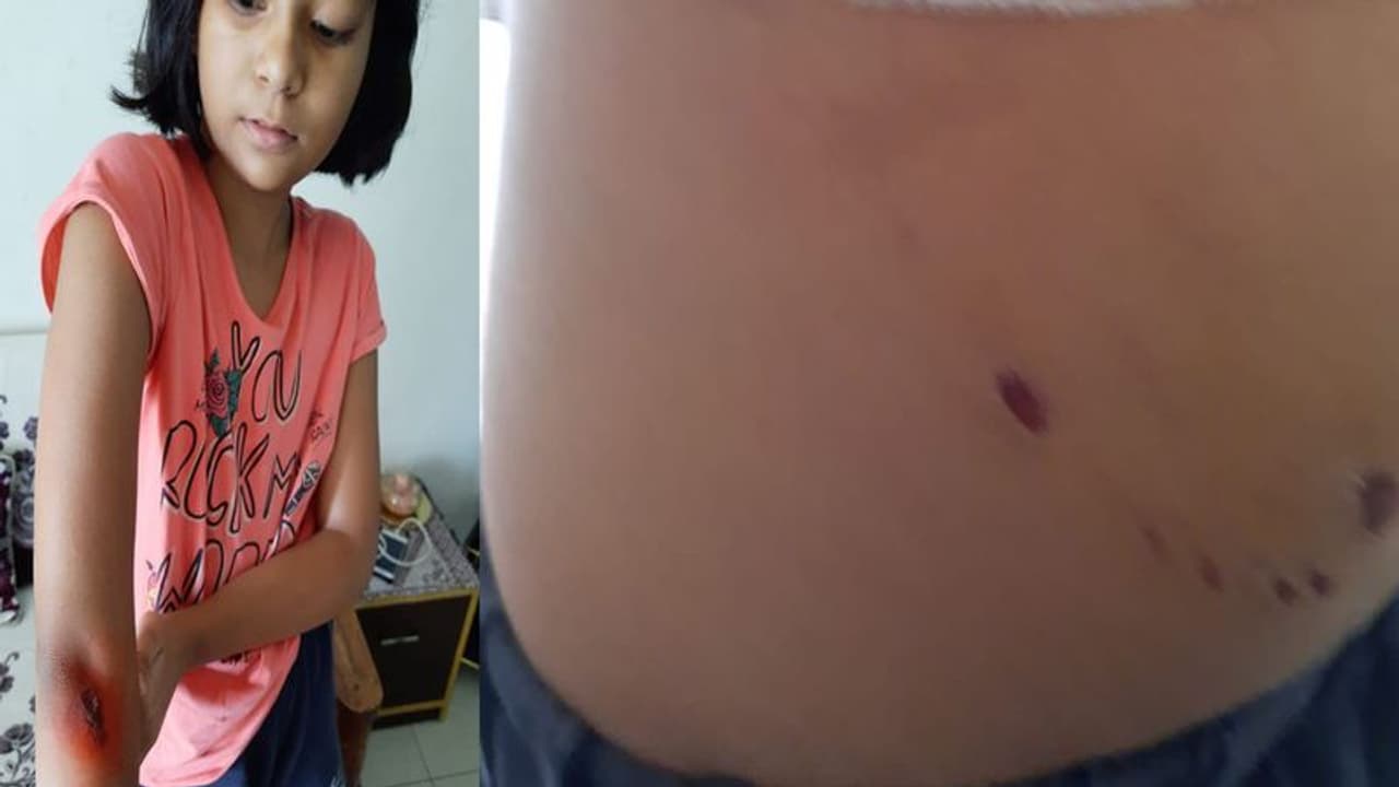 जयपुर में कोचिंग जा रही बच्ची के साथ सड़क पर हुआ दर्दनाक हादसा, चीख सुन बचाने के लिए दौड़ पड़े लोग जयपुर में कोचिंग जा रही बच्ची के साथ सड़क पर हुआ दर्दनाक हादसा, चीख सुन बचाने के लिए दौड़ पड़े लोग