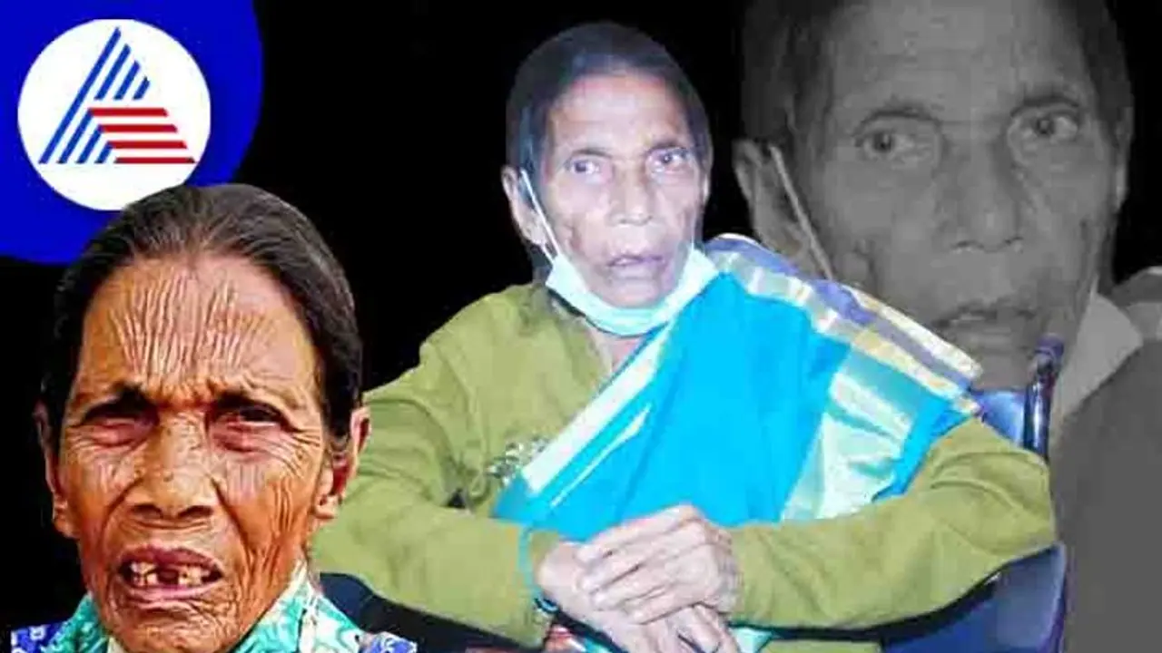 ಕಳಚಿತು ಪಾರಂಪರಿಕ ವೈದ್ಯ ಪದ್ದತಿಯ ಕೊಂಡಿ: 10 ಸಾವಿರಕ್ಕೂ ಹೆಚ್ಚು ಹೆರಿಗೆ ಮಾಡಿಸಿದ್ದ ಸುಲ್ತಾನಮ್ಮ ಇನ್ನಿಲ್ಲ ಕಳಚಿತು ಪಾರಂಪರಿಕ ವೈದ್ಯ ಪದ್ದತಿಯ ಕೊಂಡಿ: 10 ಸಾವಿರಕ್ಕೂ ಹೆಚ್ಚು ಹೆರಿಗೆ ಮಾಡಿಸಿದ್ದ ಸುಲ್ತಾನಮ್ಮ ಇನ್ನಿಲ್ಲ