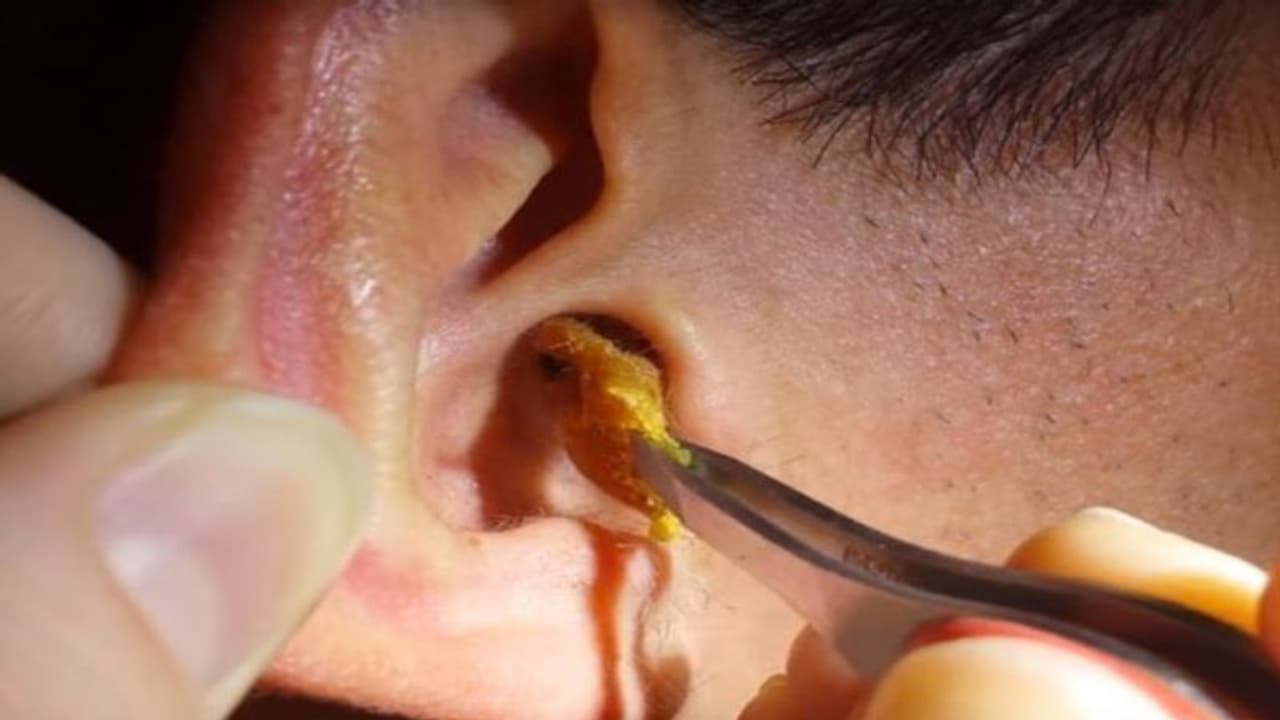 महिला ने बताई ब्वॉयफ्रेंड की बुरी आदतें, कहा अपने ही शरीर की गंदगी खाता है, क्या करूं इसका 