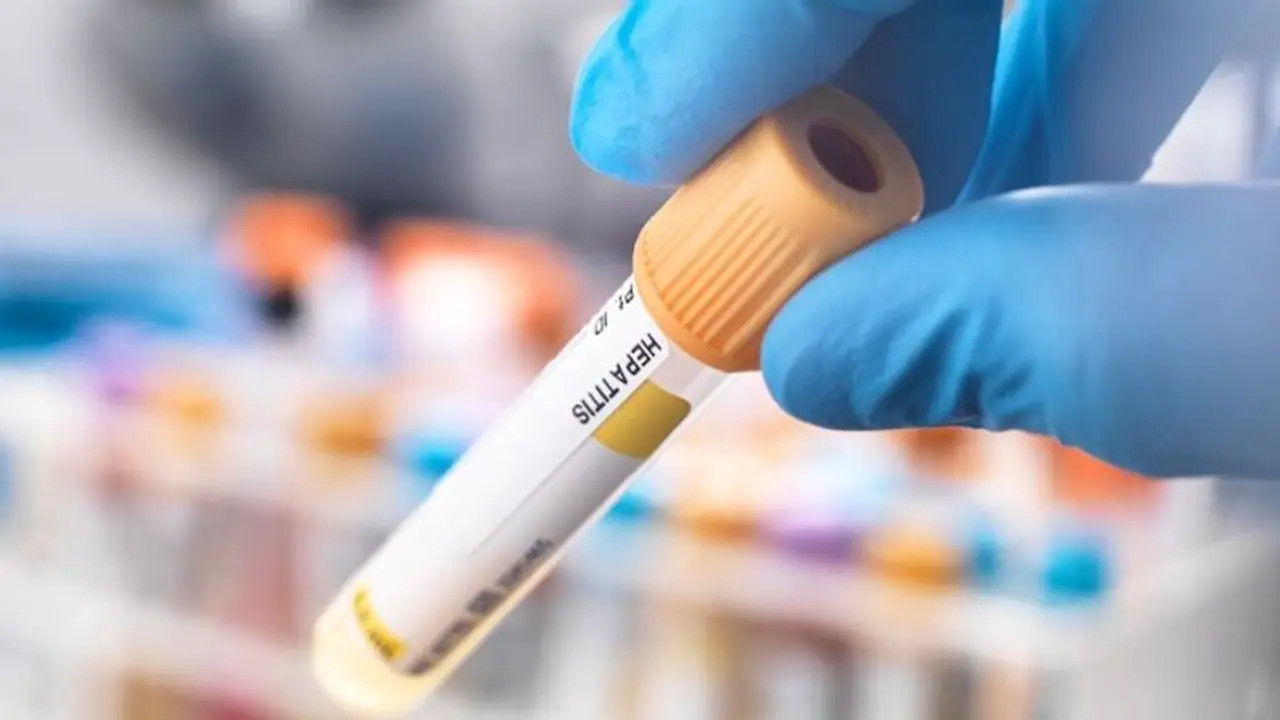  മേമുണ്ട ഹയർ സെക്കന്ററി സ്കൂളിലെ 23വിദ്യാർത്ഥികൾക്ക് മഞ്ഞപ്പിത്തം; 3 കടകൾ അടപ്പിച്ചു, വെള്ളം പരിശോധിക്കും