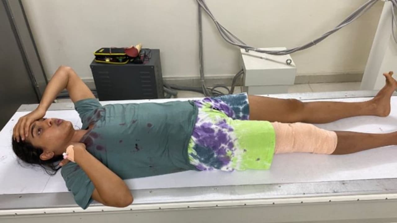 ಬೆಂಗಳೂರು: ಶೂಟಿಂಗ್ ವೇಳೆ ನಟಿ ಸಂಯುಕ್ತ ಹೆಗ್ಡೆಗೆ ಅಪಘಾತ ಬೆಂಗಳೂರು: ಶೂಟಿಂಗ್ ವೇಳೆ ನಟಿ ಸಂಯುಕ್ತ ಹೆಗ್ಡೆಗೆ ಅಪಘಾತ