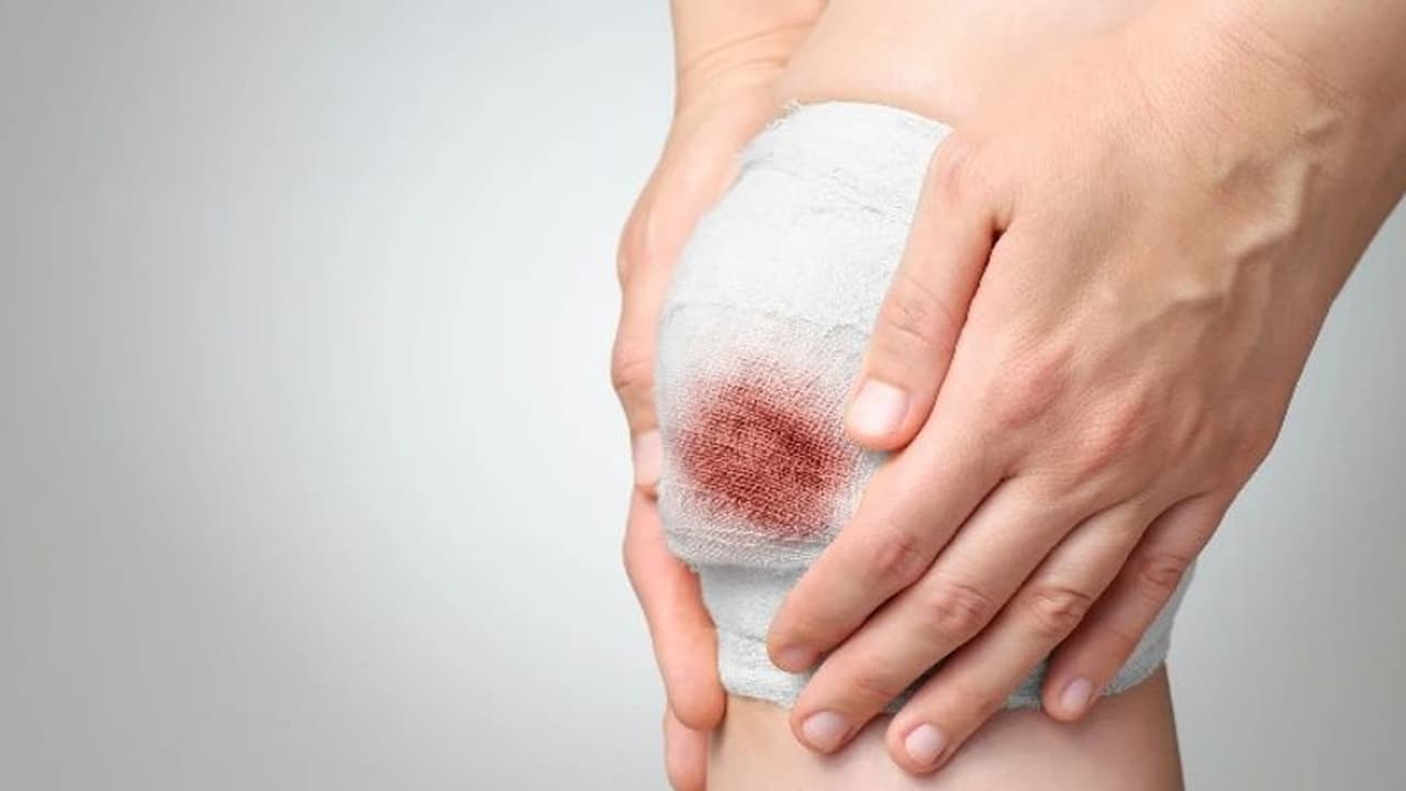 Diet Tips : മുറിവുകള് പെട്ടെന്ന് ഭേദമാകാനും പ്രതിരോധശേഷിക്കും കഴിക്കേണ്ട ഭക്ഷണങ്ങള് Diet Tips : മുറിവുകള് പെട്ടെന്ന് ഭേദമാകാനും പ്രതിരോധശേഷിക്കും കഴിക്കേണ്ട ഭക്ഷണങ്ങള്