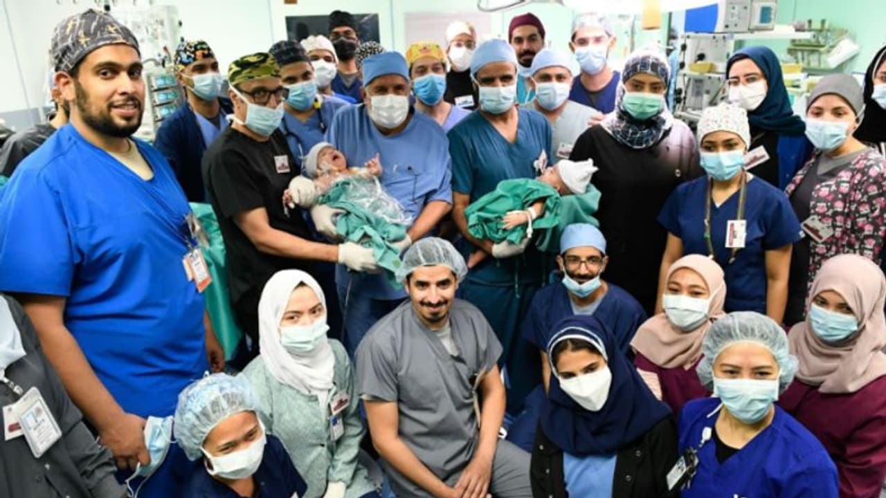 യെമനി സയാമീസ് ഇരട്ടകളായ മവദ്ദയും റഹ്മയും റിയാദിൽ നടന്ന ശസ്ത്രക്രിയയിൽ വേറിട്ടു